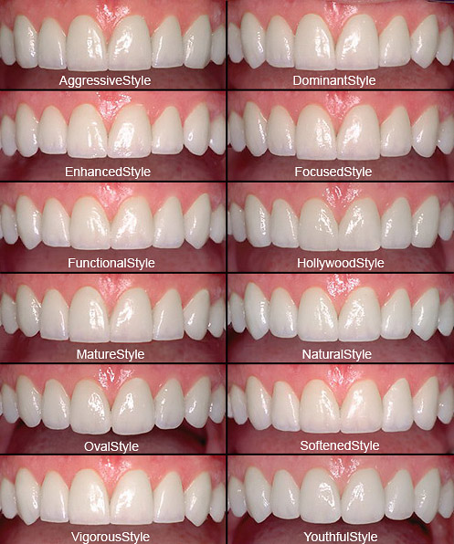 smile makeover