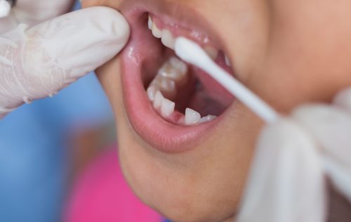 pediatric dentist in Sugar Land, TX