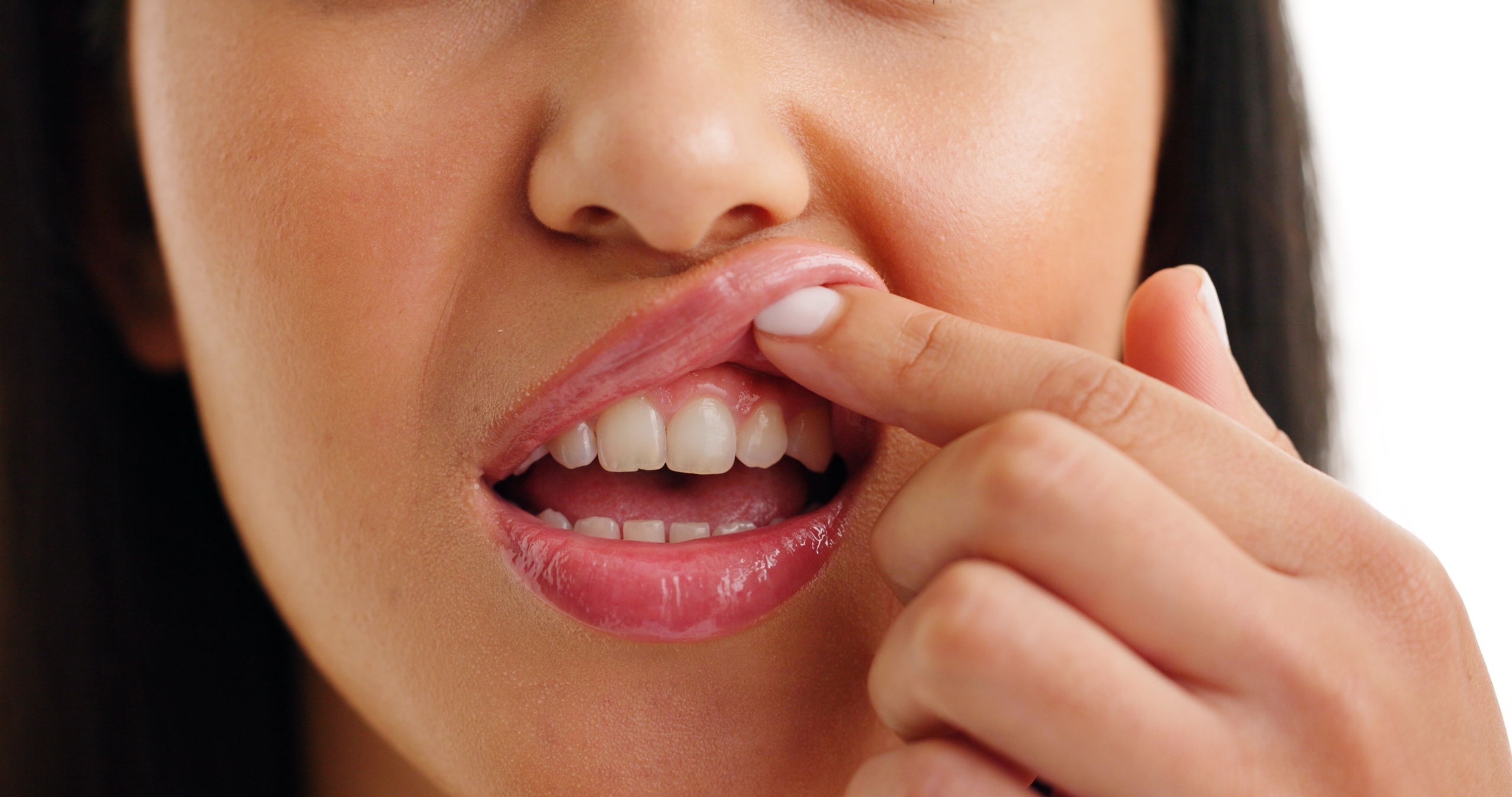 Are bleeding gums normal when brushing?